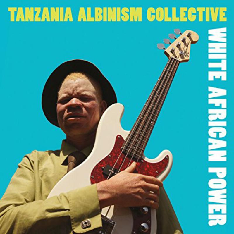 Tanzania Albinism: White African Power