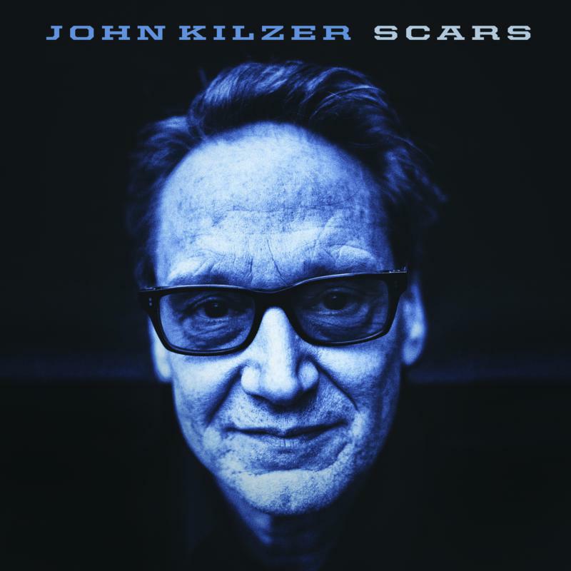 John Kilzer: Scars